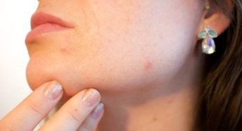 Belle peau : à la rescousse de mon foie